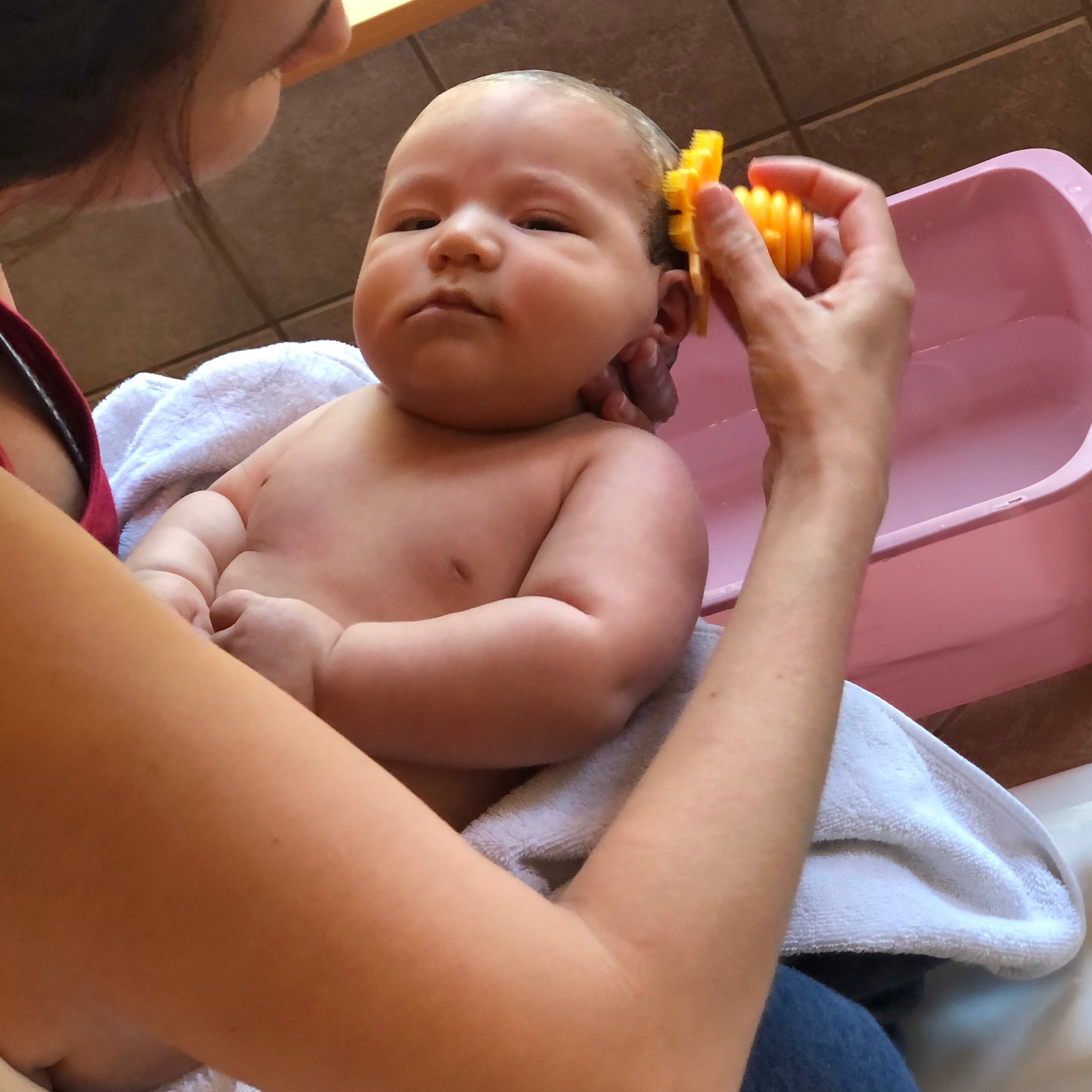 Caring for Cradle Cap